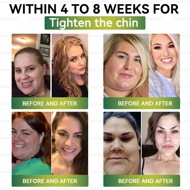 CrazyLeaf® 💎Meglutide GLP-1 Activating Oral Solution with Collagen & Matrixyl 3000|💎Obesity,Cardiovascular Diseas, Diabetes, Sleep Apnea, Joint Problems and More