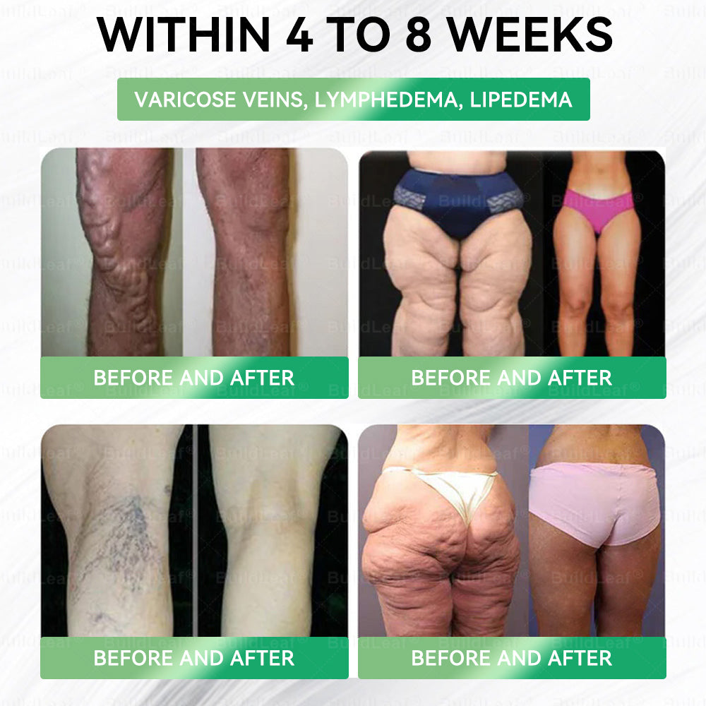 ⏰ Only a few packs left in stock! Enjoy an extra 30% OFF now! A slimmer body and more energy are within your reach! If you miss it this time, you’ll have to wait until next year for the next chance! ⏰𝑩𝒖𝐢𝒍𝒅𝑳𝒆𝐚𝒇®