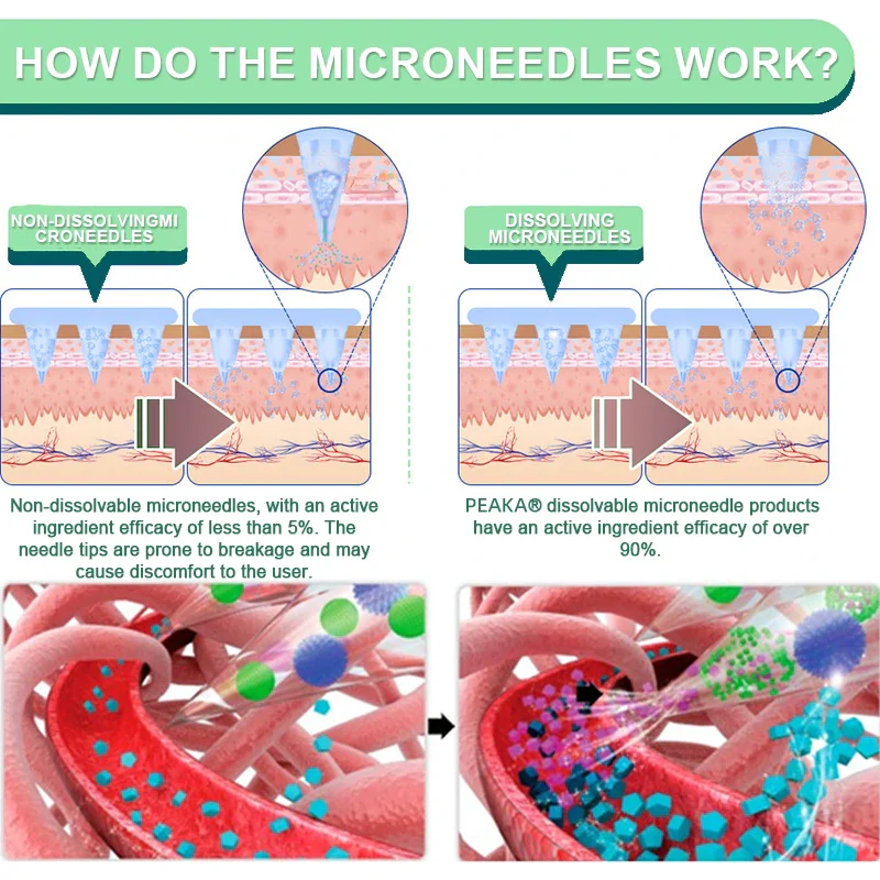 【Final Day – 80% OFF 💜】FANSHEN® NIDDK-Tirzepatide Slimming & Health Nano Microneedle Patch🇬🇧 Painless | 24/7 Fat-Burning Support | Drop a Stone Fast | Up to 90% Sugar Reduction