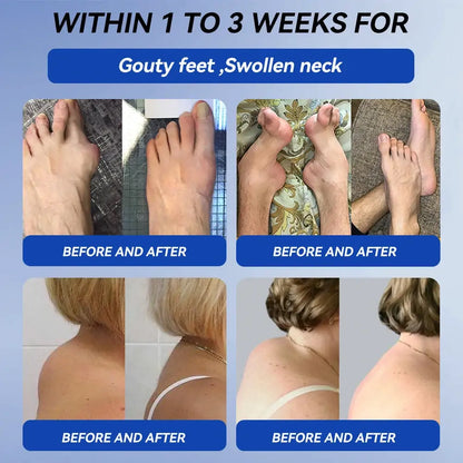 | 𝐋𝐚𝐬𝐭 𝐃𝐚𝐲 𝐏𝐫𝐨𝐦𝐨𝐭𝐢𝐨𝐧 𝟖𝟎% 𝐎𝐅𝐅🇬🇧 FANSHEN® 𝐁𝐏𝐂-𝟏𝟓𝟕 𝐉𝐨𝐢𝐧𝐭 𝐇𝐞𝐚𝐥𝐢𝐧𝐠 𝐂𝐫𝐞𝐚𝐦 - 🦴 (Behandelt Arthritis, Neuropathie, Rheuma, Sportverletzungen und mehr)🏆